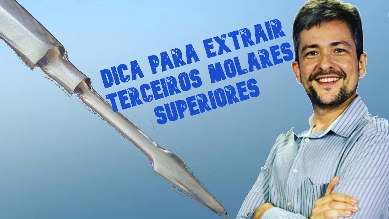 Dica para extrair 3 molar superior + sorteio exclusivo!