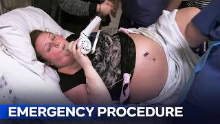 The Raw Reality Of The Maternity: High-Risk C-Section | Midwives