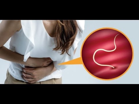 anti parazita kezelés a helminták bélféreg termeszetes gyógymod