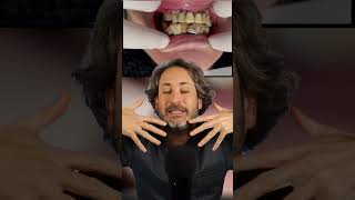 Después de ver ESTO, IRÁS   🏃CORRIENDO a lavarte los dientes - ¿que ocurre si NO me QUITO el SARRO