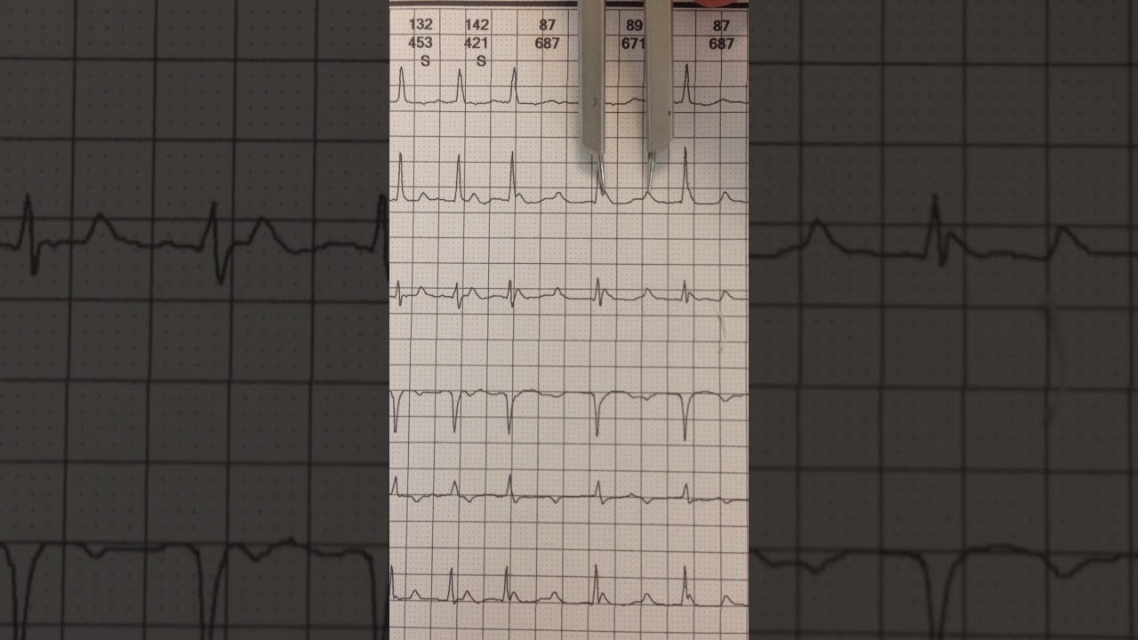 Ayax N. Sobrino Saavedra-12
