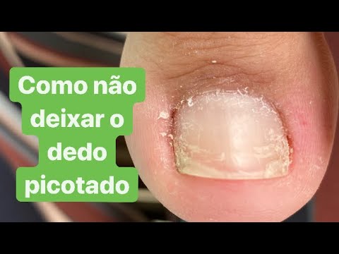 , title : 'COMO NÃO DEIXAR AS UNHAS PICOTADAS.Dicas para um acabamento perfeito'