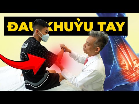Đau Khuỷu Tay Không Thể Cầm Nắm? Nguyên Nhân Chấn Thương & Cách Chữa