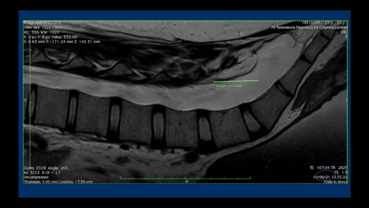 Aurelio Ponce Ayala-12
