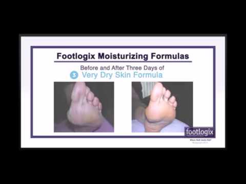 Footlogix 2 3 3+ Moisturizing Formulas   For Dry, Cracked Skin