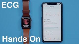 Hands-On With the ECG Feature for Apple Watch Series 4!