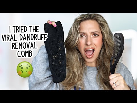 I TRIED THE VIRAL DANDRUFF REMOVAL COMB- DOES IT ACTUALLY WORK?