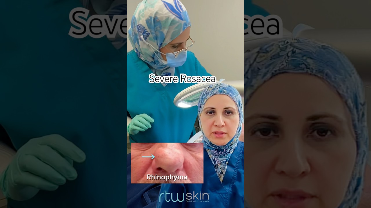 YouTube Video Preview