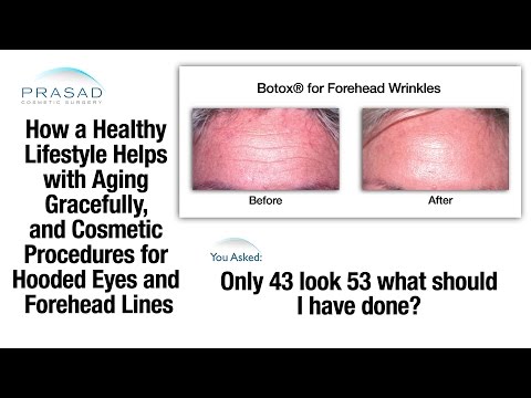 How to Improve Appearance of the Forehead Area with Upper Eyelid Surgery and Botox Treatment