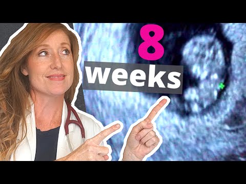 8 Week Ultrasound | PLUS how to Help with Morning Sickness