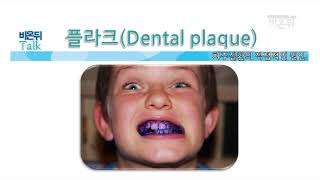 치주질환의 원인과 치료, 예방법