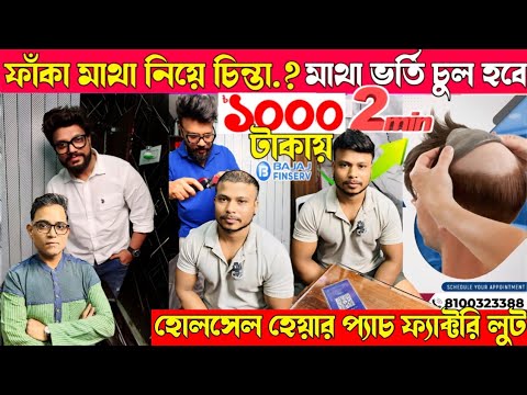 হোলসেল💥Best hair patch Shop in Kolkata|Frontline hair patch|Hair wig for men|Non surgical hair patch