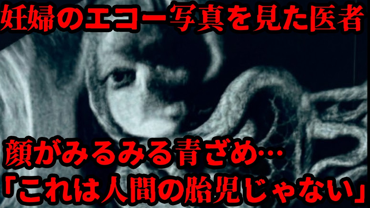 【実話】エコー写真で不気味な胎児に怯える医者…その原因は妊婦の元夫の罰当たりな行動が原因でした…