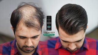 Hair Style For Very Thin & Balding Hair by using Hair Fibers 2022