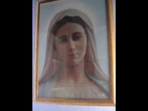 Siero di Mary Kaye da posti di pigmentary I pigmentary notano su un naso dopo rhinoplasty