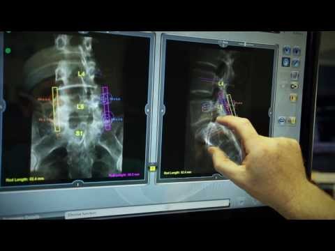OADOC Mazor Robotics | Houston Renaissance Spine Surgery