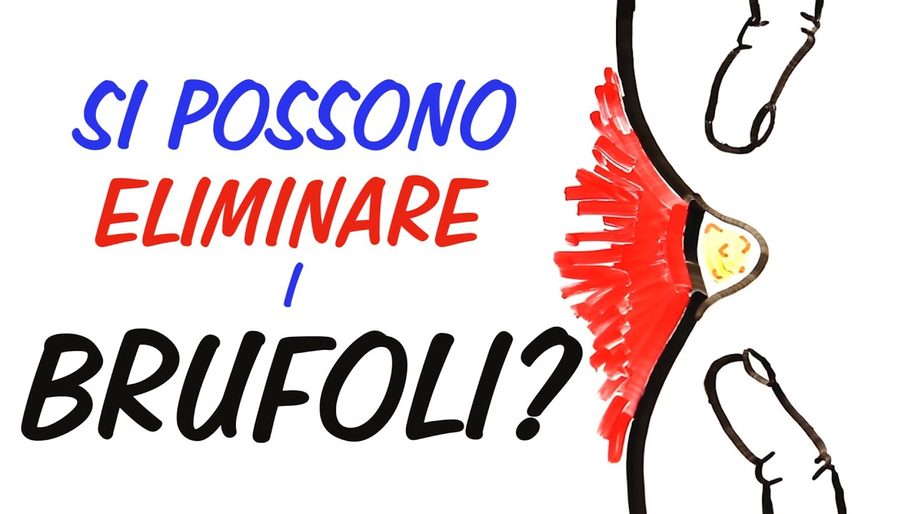 Si possono eliminare i brufoli LA SCIENZA DELL'ACNE