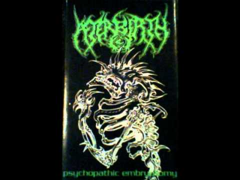 AFTERBIRTH-aborted christ