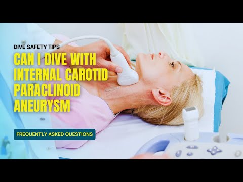 FAQ Diagnosis carotid paraclinoid segment aneurysm - Can I dive?