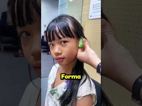 IL MEDICO LE HA SALVATO L’UDITO CON UN METODO INCREDIBILE 😱 #shorts