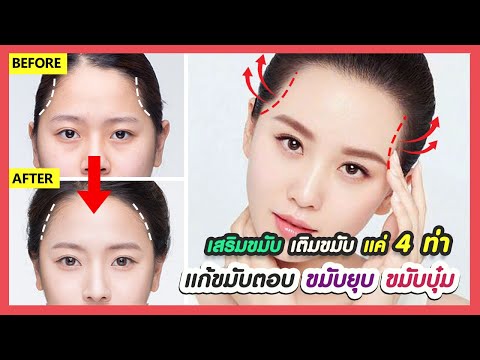 4 ท่า!! วิธีแก้ขมับตอบ ขมับยุบ ขมับบุ๋ม ปรับรูปหน้าให้สดใส (เสริมขมับ เติมขมับ ไม่ต้องฟิลเลอร์)