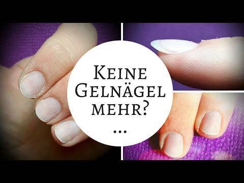 Der Preis lozerila in den Apotheken ischewska Gribok der Nägel die Behandlung die Präparate die preiswerten aber ergebnisreichen Lacke ihr Preis