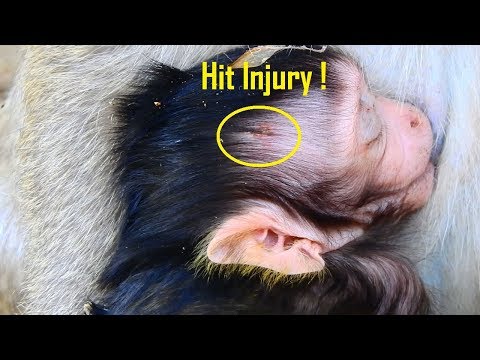 P1 HEAD Injury, Lizza Got Injury On Head Look So Sad What Happening Like this On head