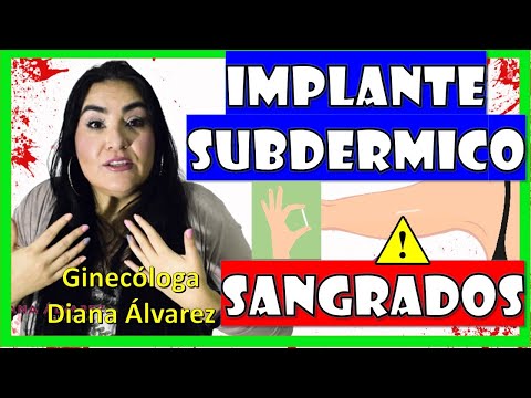 SANGRADOS con IMPLANTE SUBDERMICO; ¿Por Qué? ¿Qué Hacer?; por GINECOLOGA DIANA ALVAREZ