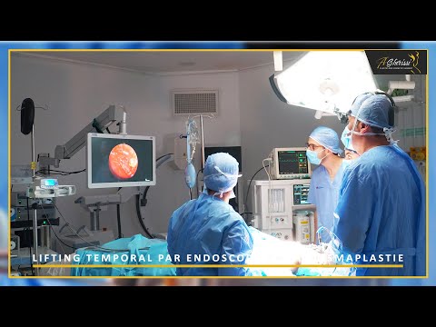 Lifting temporal par endoscopie et platysmaplastie