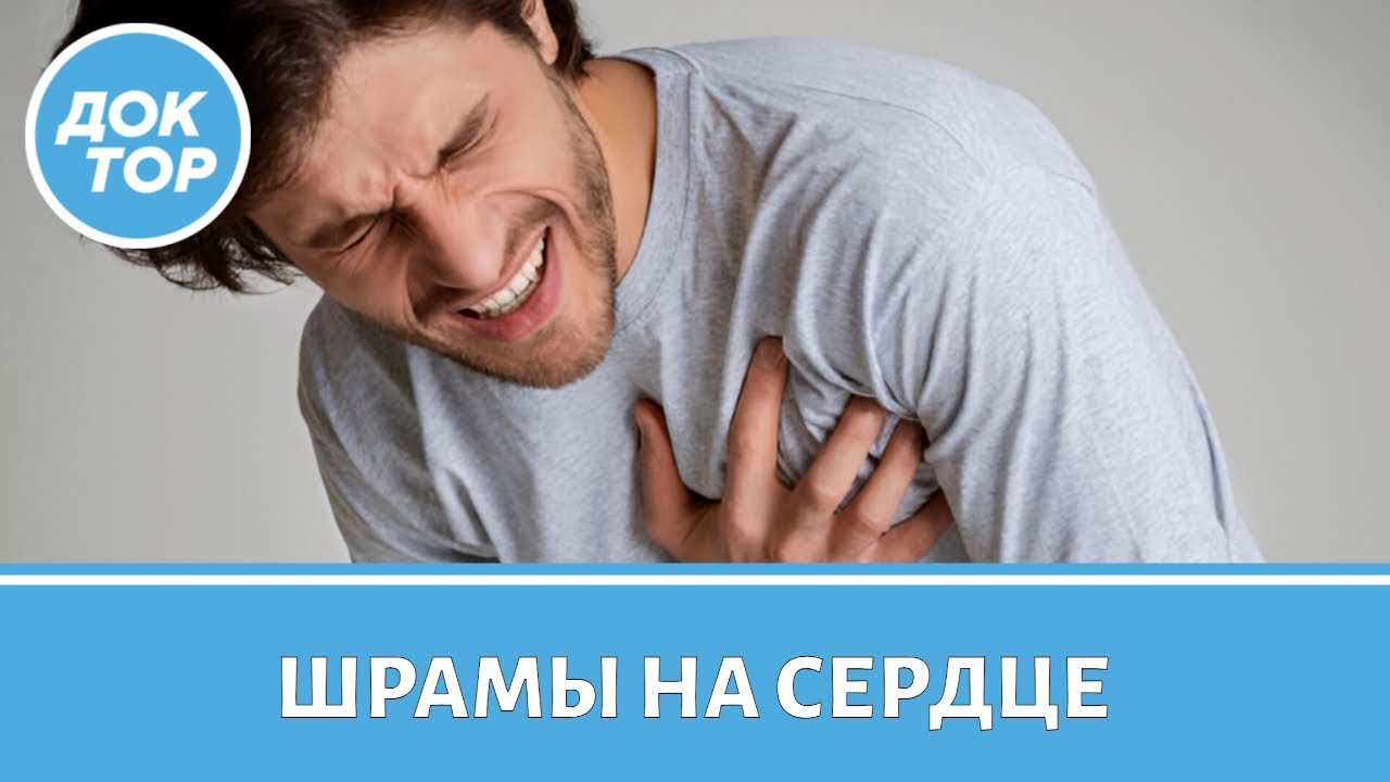 Как восстановиться после инфаркта