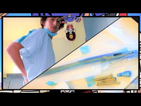 PIN UIT MIJN BEEN HALEN - OPERATIE! #5