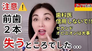【注意⚠️】セカンドオピニオンをオススメ!!歯を抜いてインプラントを勧める歯科医・治療費140万円 #健康 #歯医者 #セカンドオピニオン