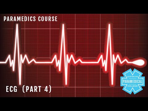 ECG Part 4 QRS - Australian Paramedical College