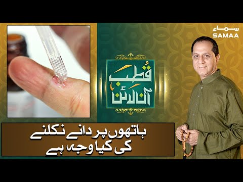 Hathon mein daanay nikalne ki kia waja | How to Get Rid of Warts on Palms |Qutb Online | SAMAA TV