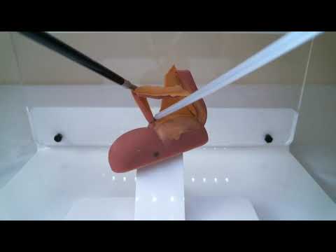 Appendix endoloop and division on Inovus Lap Trainer