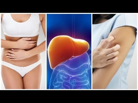 Hypertonie 1-2st. Hypertensive Krise Typen und Unterstützung