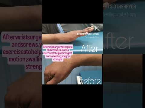 Before and After 23 January 2025