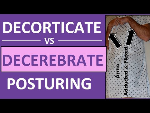 Decerebrate vs Decorticate Posturing Rigidity Mnemonic & Pictures Nursing NCLEX