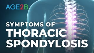 What Are the Symptoms of Thoracic Spondylosis? Thoracic (Mid-Back) Pain or Disc. Spondylolisthesis