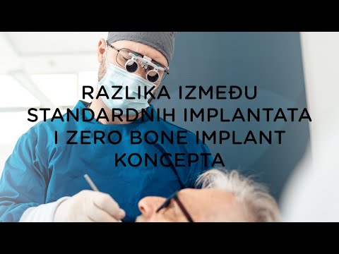 Sve što trebate znati o ZERO BONE IMPLANT Konceptu - Stomatološka poliklinika | Štimac centar dentalne medicine