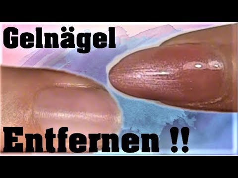 Schmerzen in der Prostata Nerven Prostata-Laser Preis Ufa