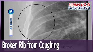 Patient with persistent cough breaks rib in a violent coughing fit｜Taiwan News