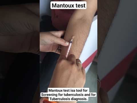 #tb#test#injection_video#useful#lab#student