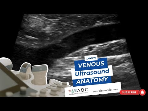 Learn Venous Ultrasound anatomy: Technical and simple way of Deep veins ultrasound