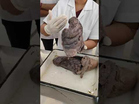 Lung anatomicl position nd side determination