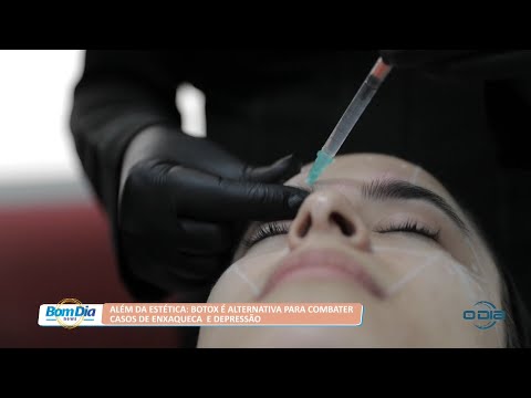 Botox é alternativa para combater casos de enxaqueca e depressão 31 03 2022