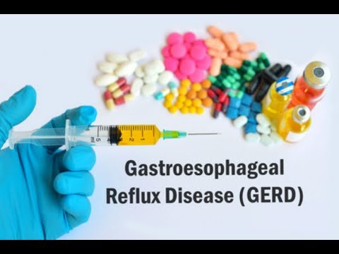 download lagu mp3 mp4 Chamomile Tea Cause Acid Reflux, download lagu Chamomile Tea Cause Acid Reflux gratis, unduh video klip Chamomile Tea Cause Acid Reflux