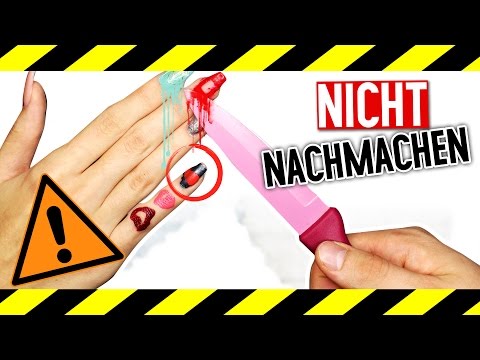 Als gribok die Köpfe von den Volkseigenen zu behandeln Die Instruktion die Salbe lozeril