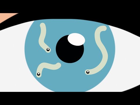 Mik azok a lebegő foltok a szemed előtt?