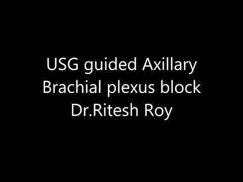Ultrasound guided Axillary Brachial plexus block
